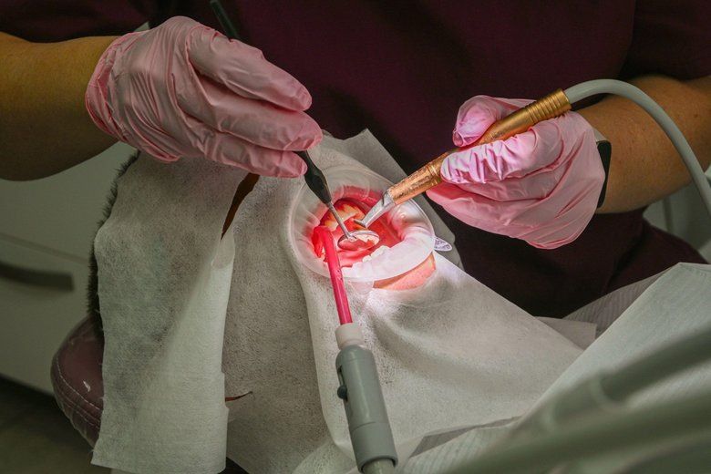 После профессиональной чистки зубов: важные советы для сохранения здоровья эмали