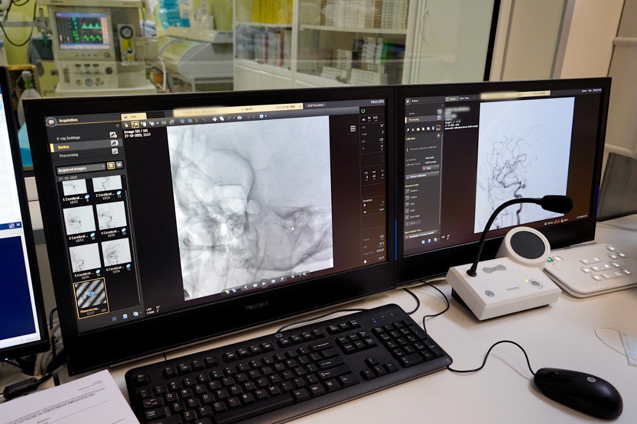 56-летнюю женщину с аневризмой головного мозга спасли новгородские врачи