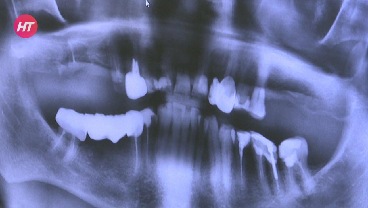 Новгородским участникам СВО начали оказывать услуги по зубопротезированию Новгородским участникам СВО начали оказывать услуги по зубопротезированию