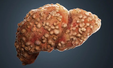 ������ ����� � ������� ����: ��� ���������� �������� ����� � ������� ������