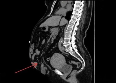 ������������ ����� ������ ��������� � ���������� ������